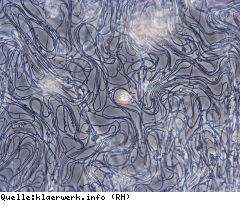 Hilfe bei Blähschlamm